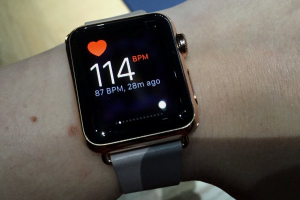 Apple Watch по сердцебиению помогли обнаружить порок сердца